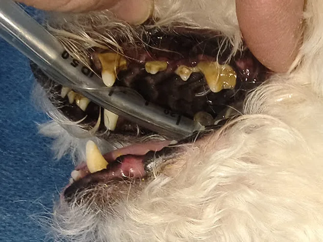 Dientes con sarro antes de la limpieza dental